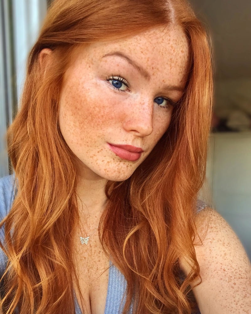 Freckled Beauty Victoria #99822623