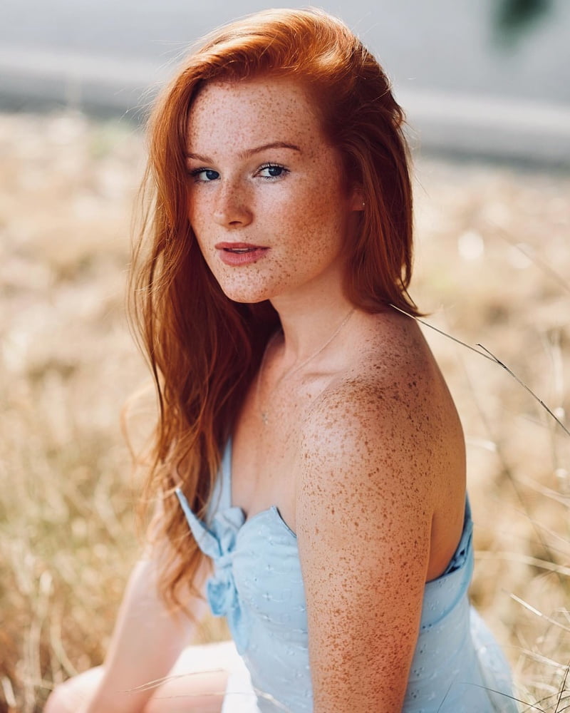 Freckled Beauty Victoria #99822624