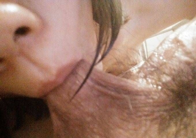 apic - 20200301 #102241694