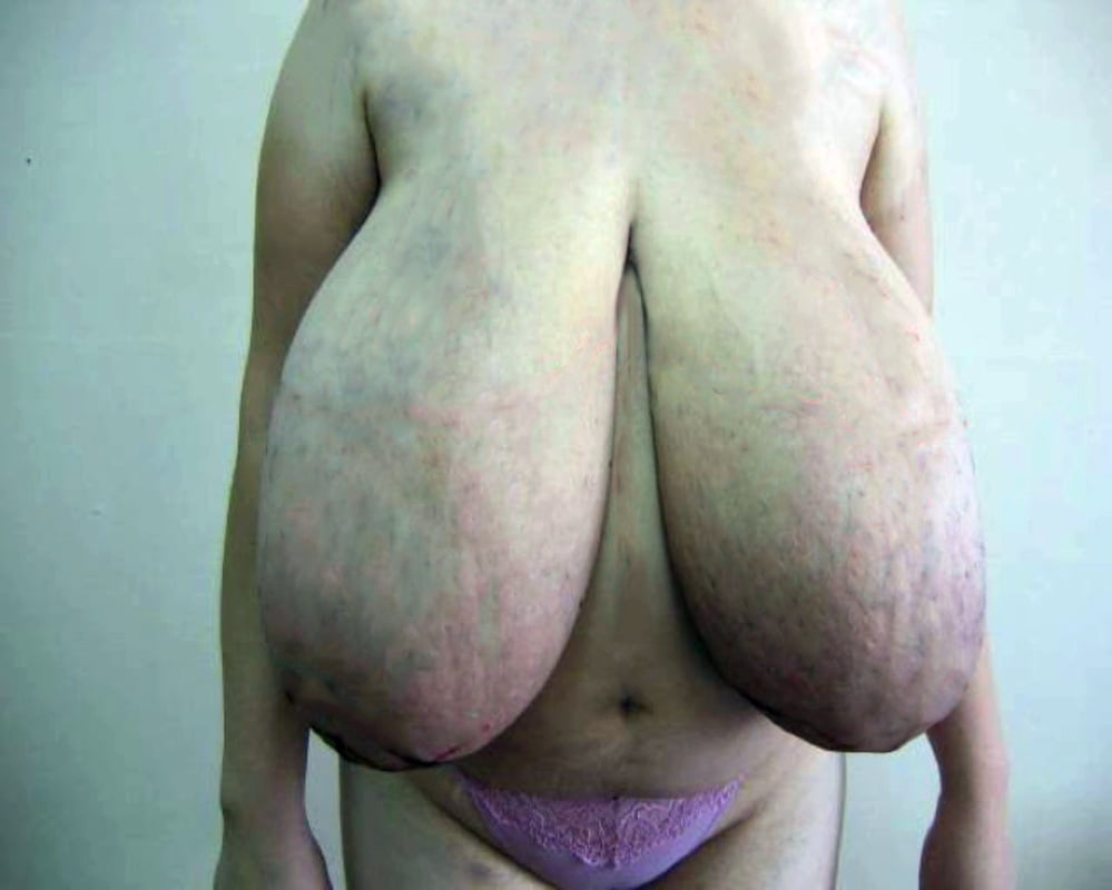 Big and huge tits, nipples, saggy, chubby, puffy, bra marks! #88865819