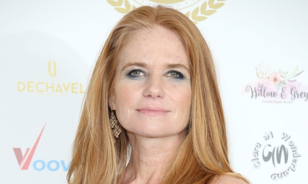 Patsy palmer
 #91565544