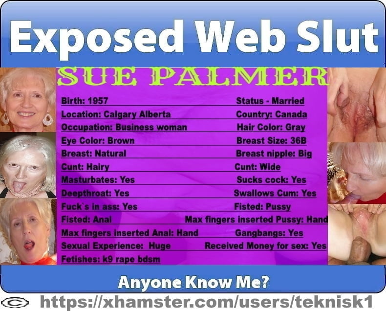Sue Fully Exposed Posters #98314598