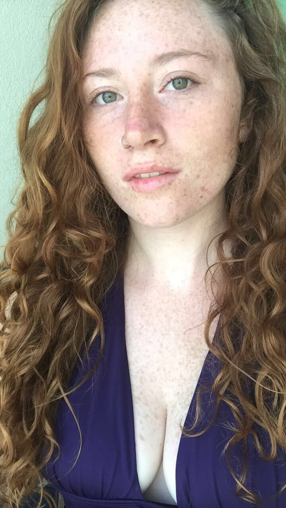 Redhead and freckles #104930248