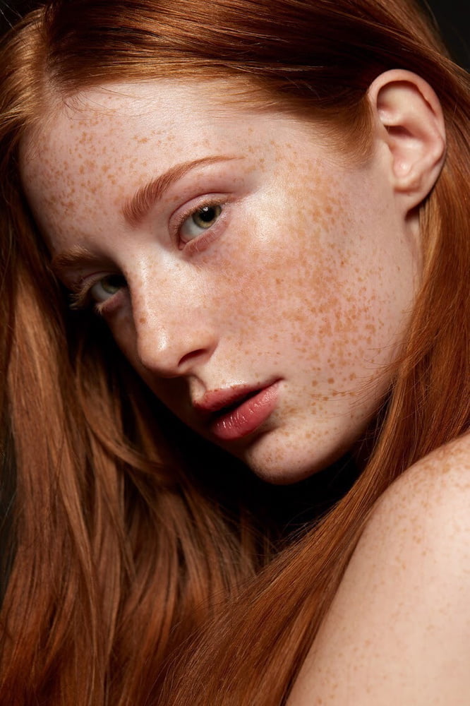 Redhead and freckles #104930326