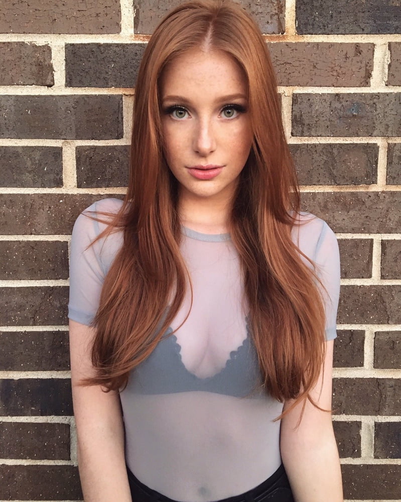 Redhead and freckles #104930329