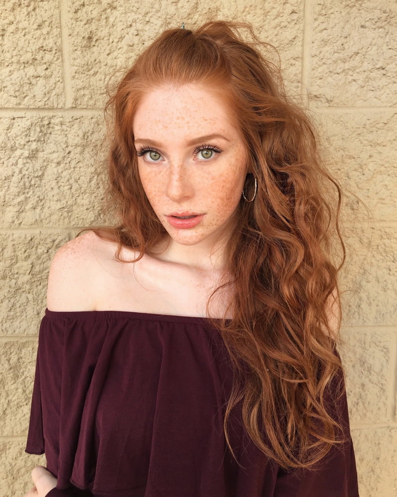 Redhead and freckles #104930338