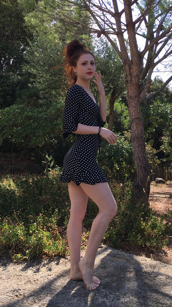 Redhead and freckles #104930390