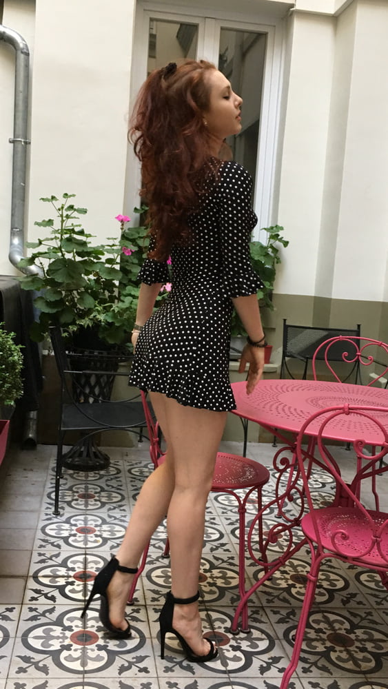 Redhead and freckles #104930396