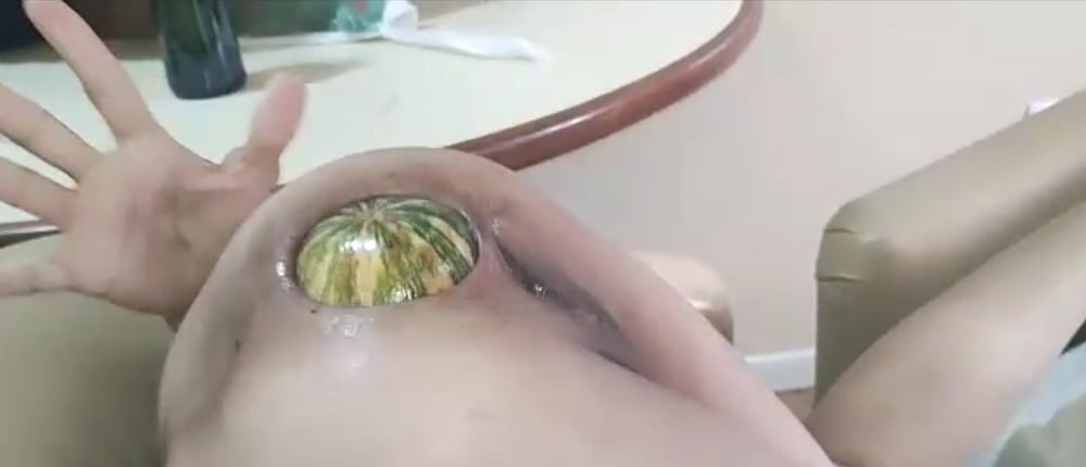 Huge bizarre insertions #82235271