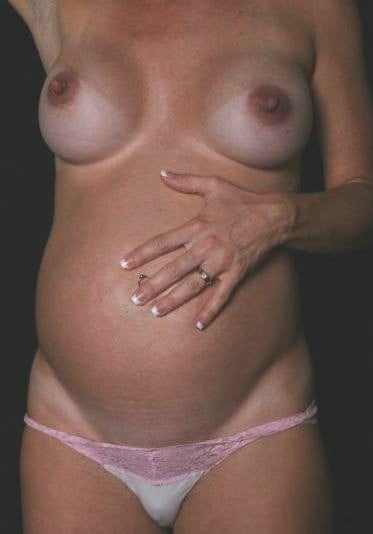 Schwangere Brustwarzen
 #93049503