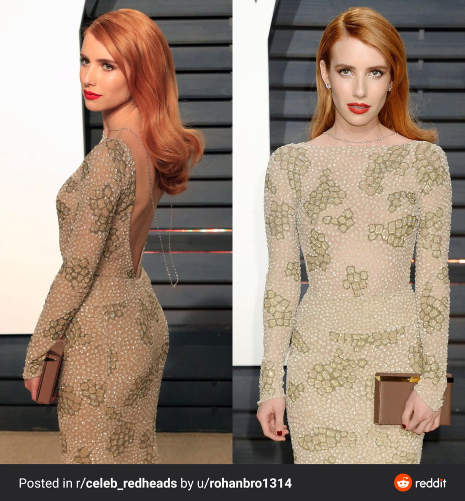 赤毛 13
 #105656953