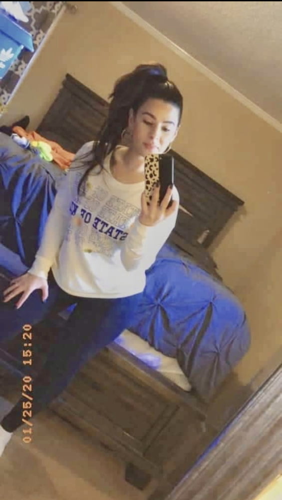 Celulitis diosas 3
 #93372942