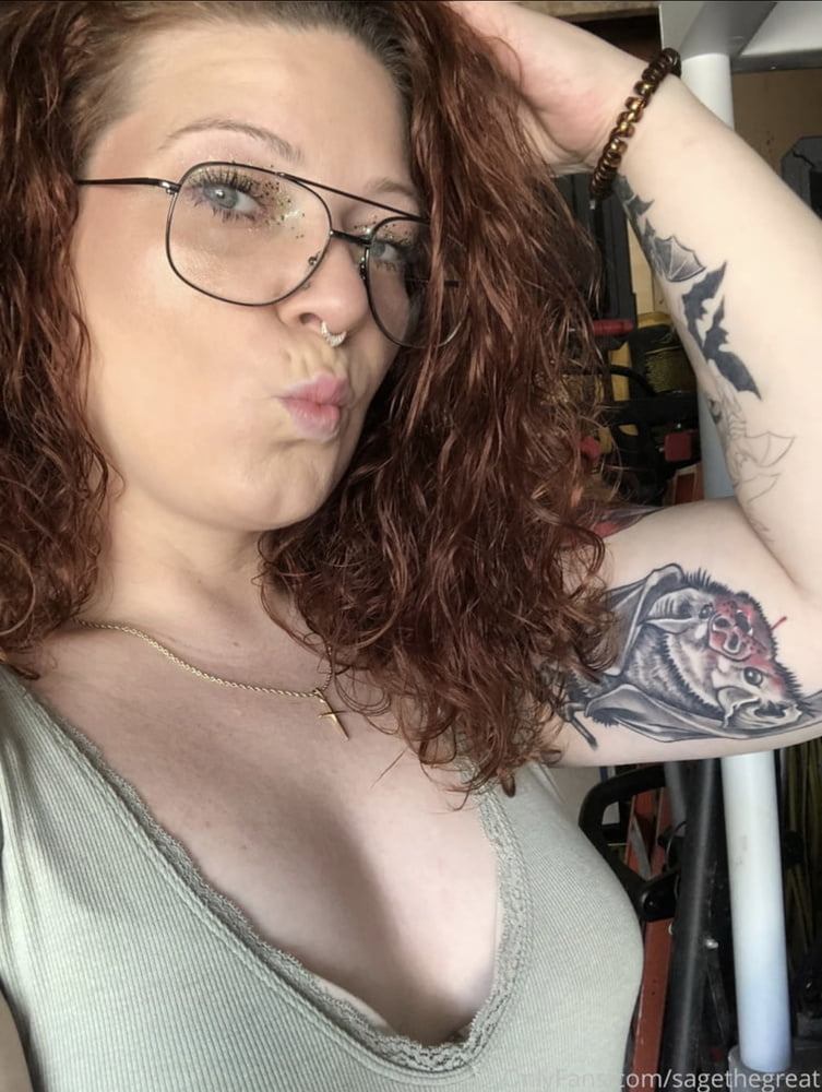 Celulitis diosas 3
 #93373037