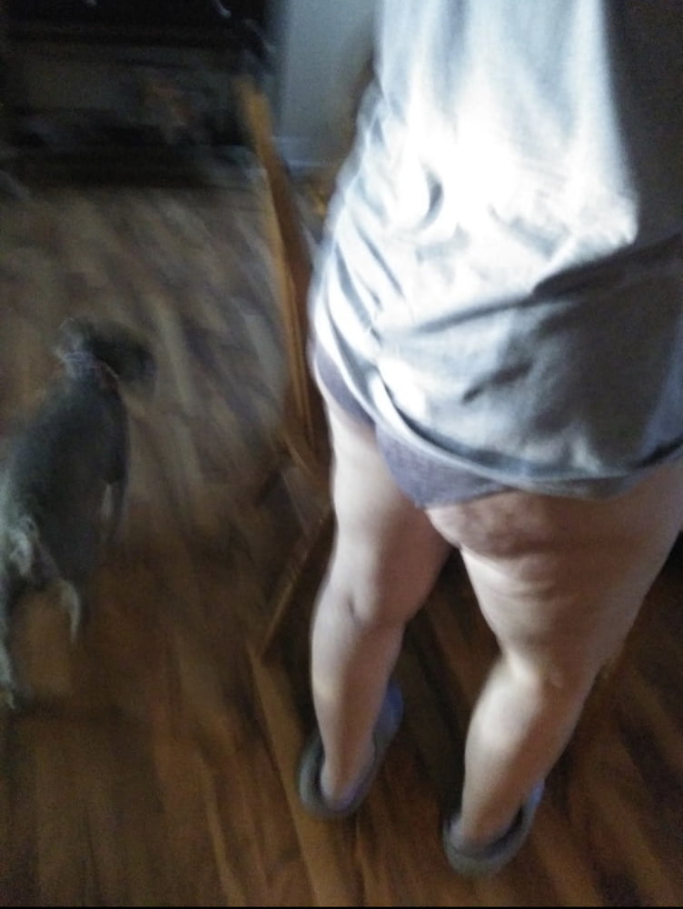 Celulitis diosas 3
 #93373186