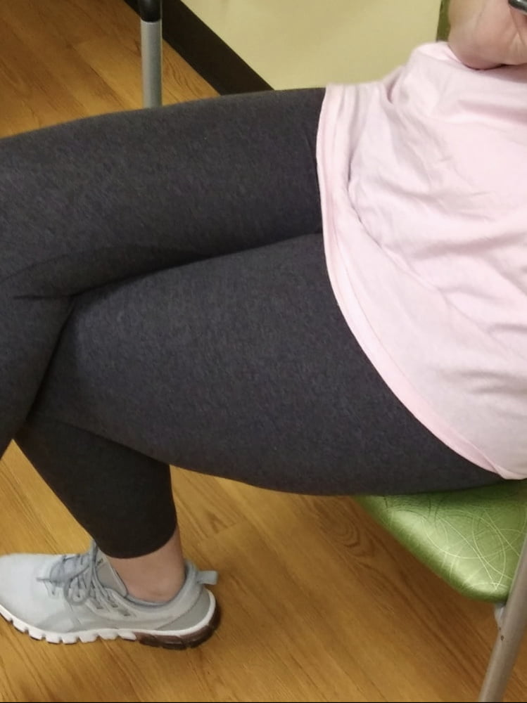 Celulitis diosas 3
 #93373189