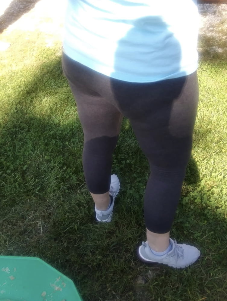 Celulitis diosas 3
 #93373201