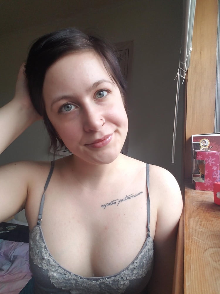 Celulitis diosas 3
 #93374065