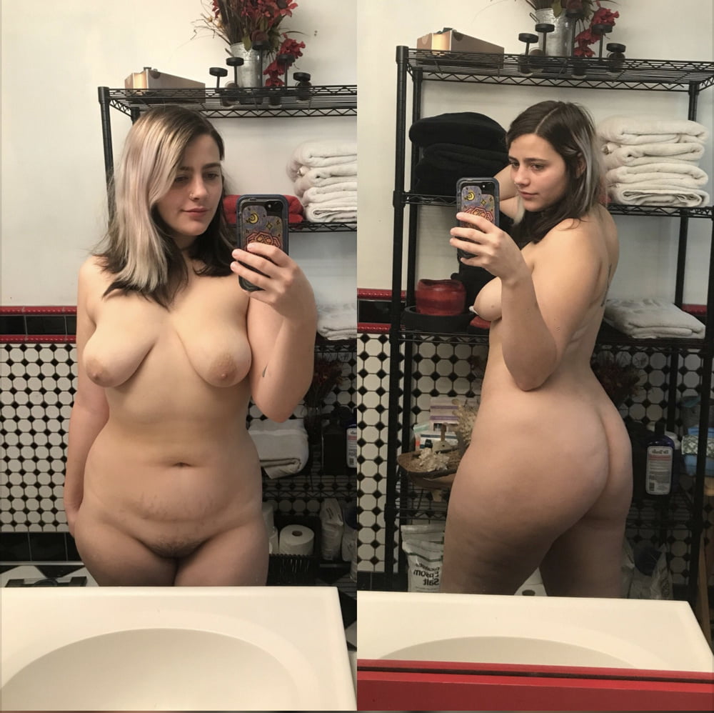 Celulitis diosas 3
 #93374232