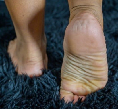 Arab wife wrinkled soles #93594541