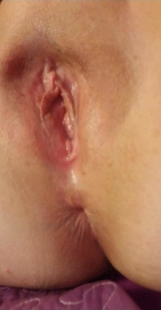 1 week post opp and starting to feel myself again...milf #107175629