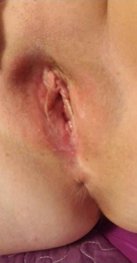 1 week post opp and starting to feel myself again...milf #107175663