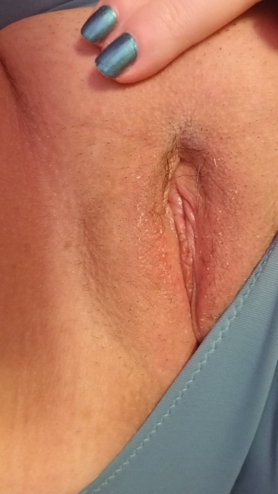 1 week post opp and starting to feel myself again...milf #107175711