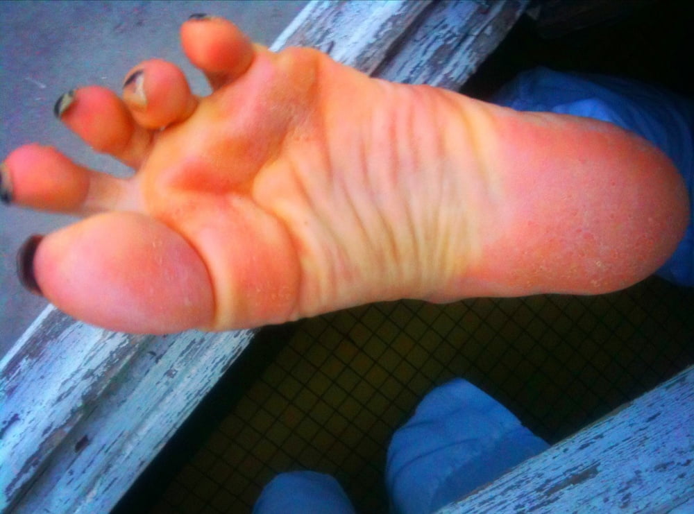 Asian ts feets, soles, toenails mix #106886978