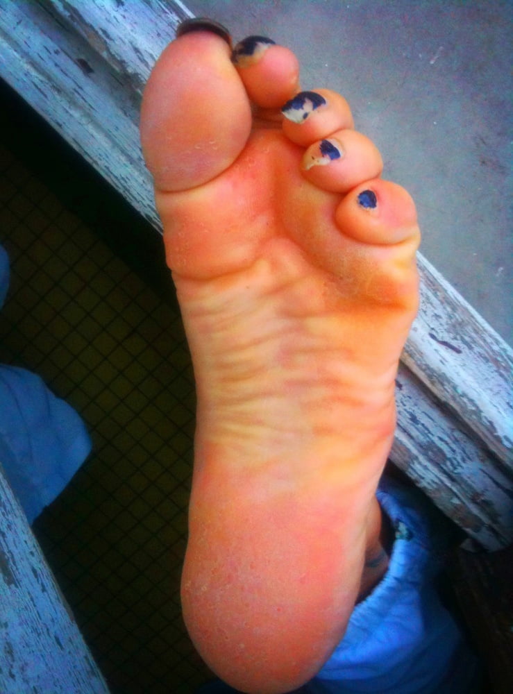 Asian ts feets, soles, toenails mix #106886981