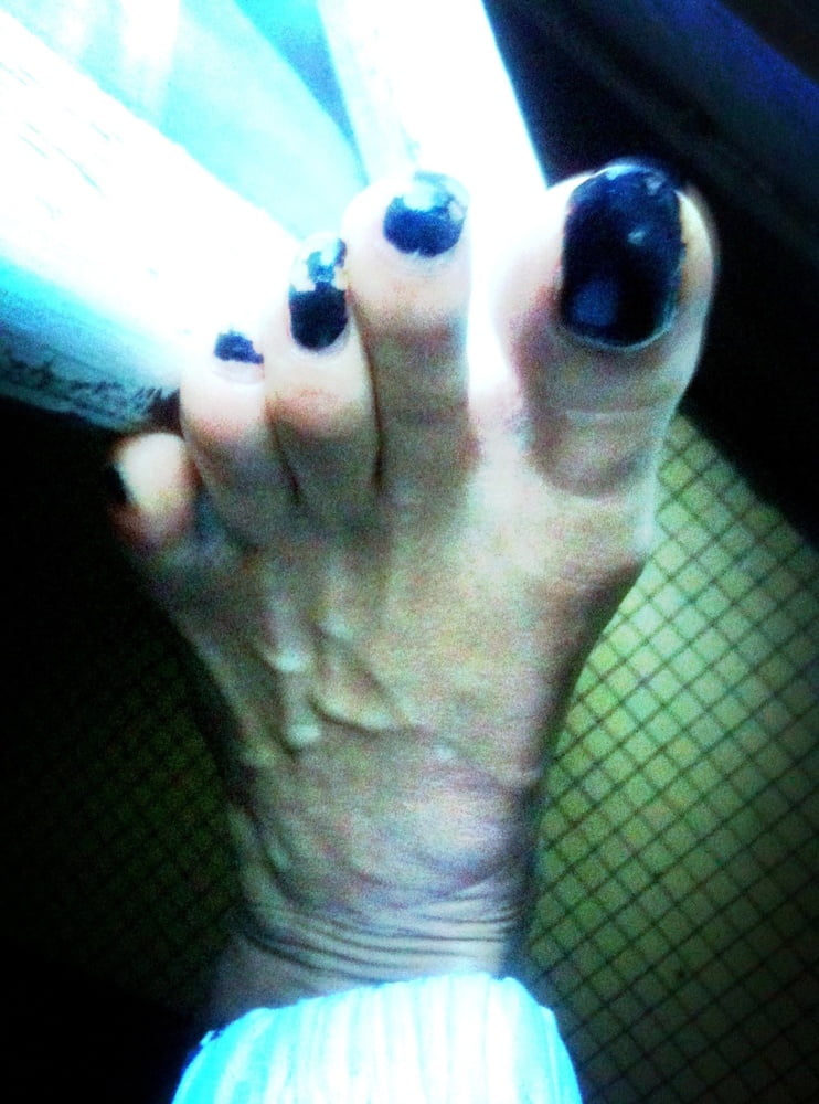 Asian ts feets, soles, toenails mix #106886986