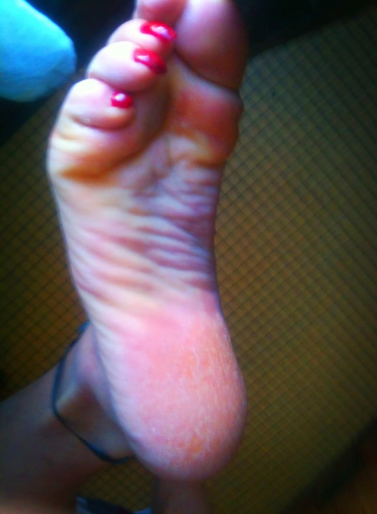 Asian ts feets, soles, toenails mix #106887023
