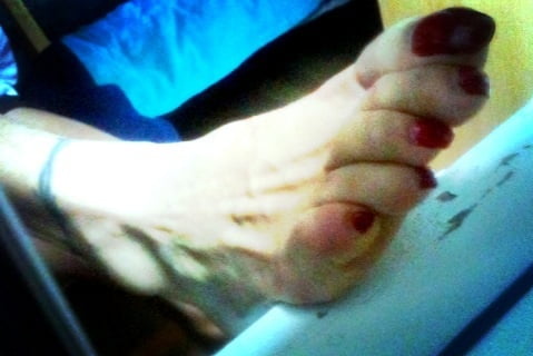 Asian ts feets, soles, toenails mix #106887032