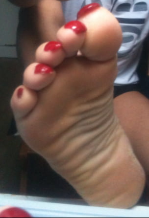 Asian ts feets, soles, toenails mix #106887035