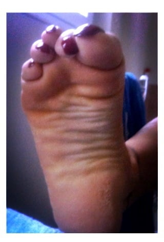 Asian ts feets, soles, toenails mix #106887041