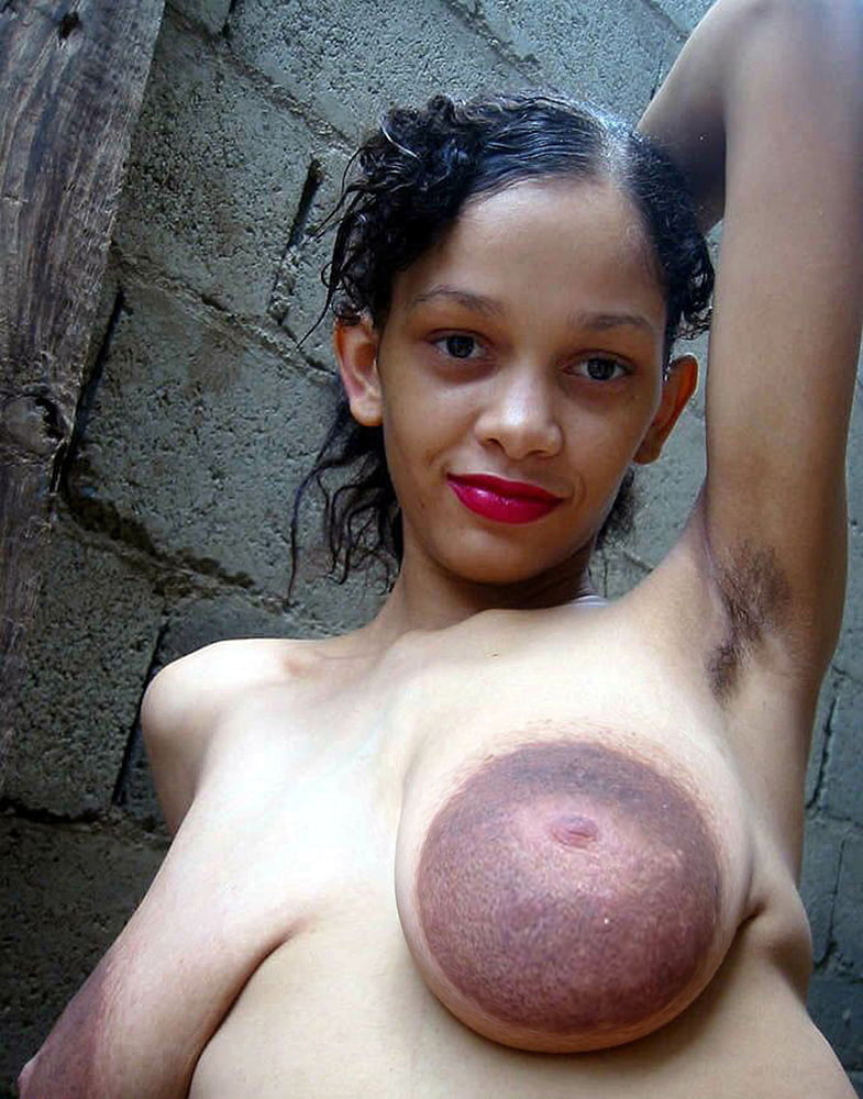 Huge areolas #89812455