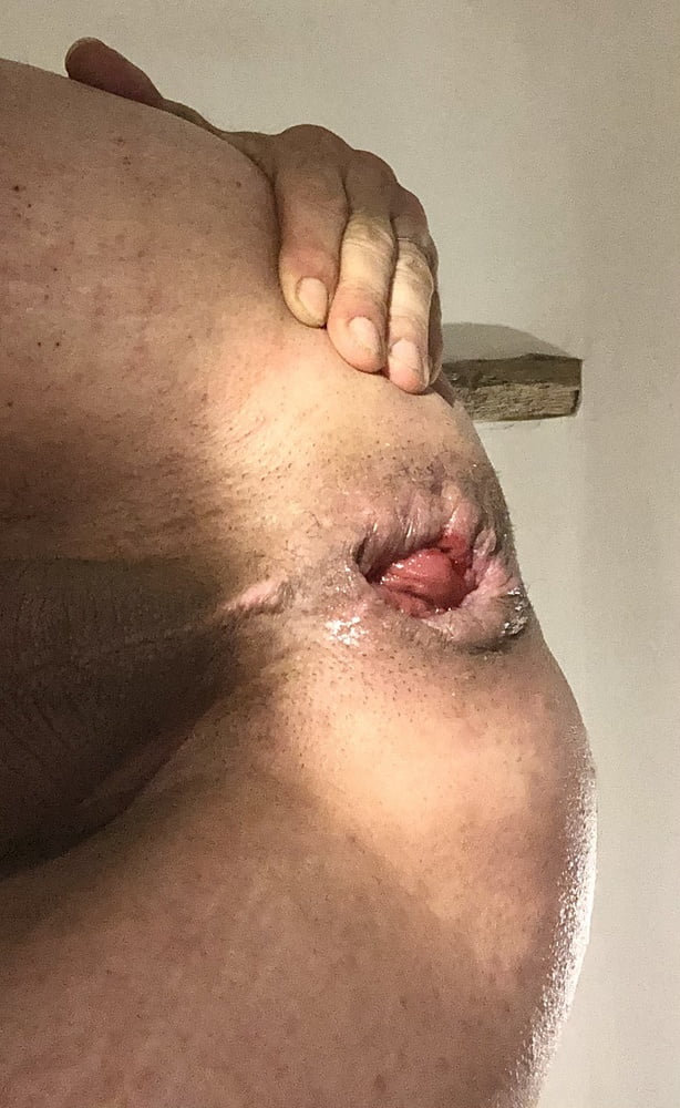 anal Dilation After Big Insertion