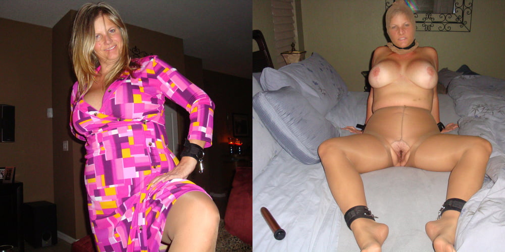 More Before and after #99962062