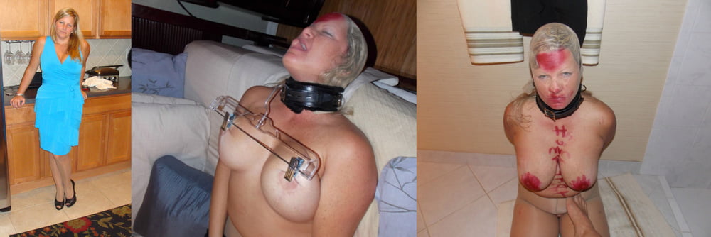 More Before and after #99962080