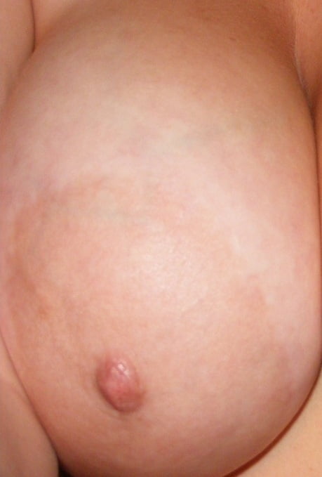 AREOLAS 5 _ 140 PHOTOS #102045689