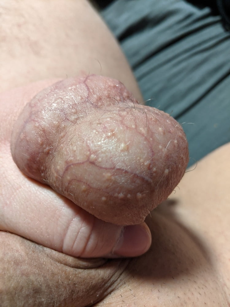 Ball Pictures #3 My balls hurting #107051377