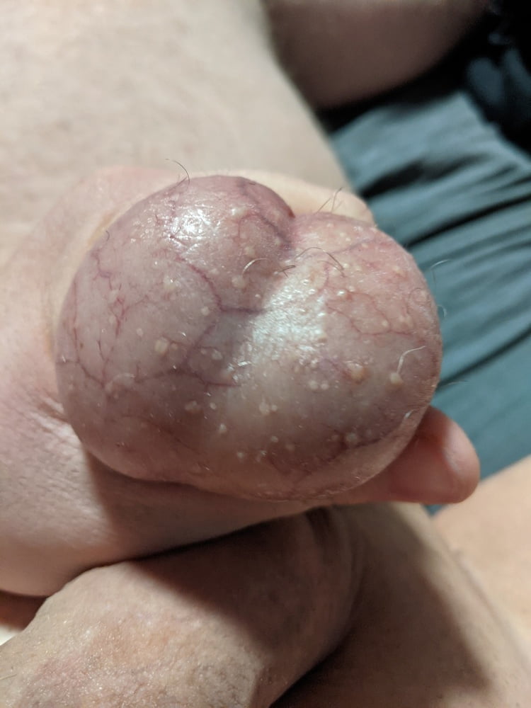 Ball Pictures #3 My balls hurting #107051379