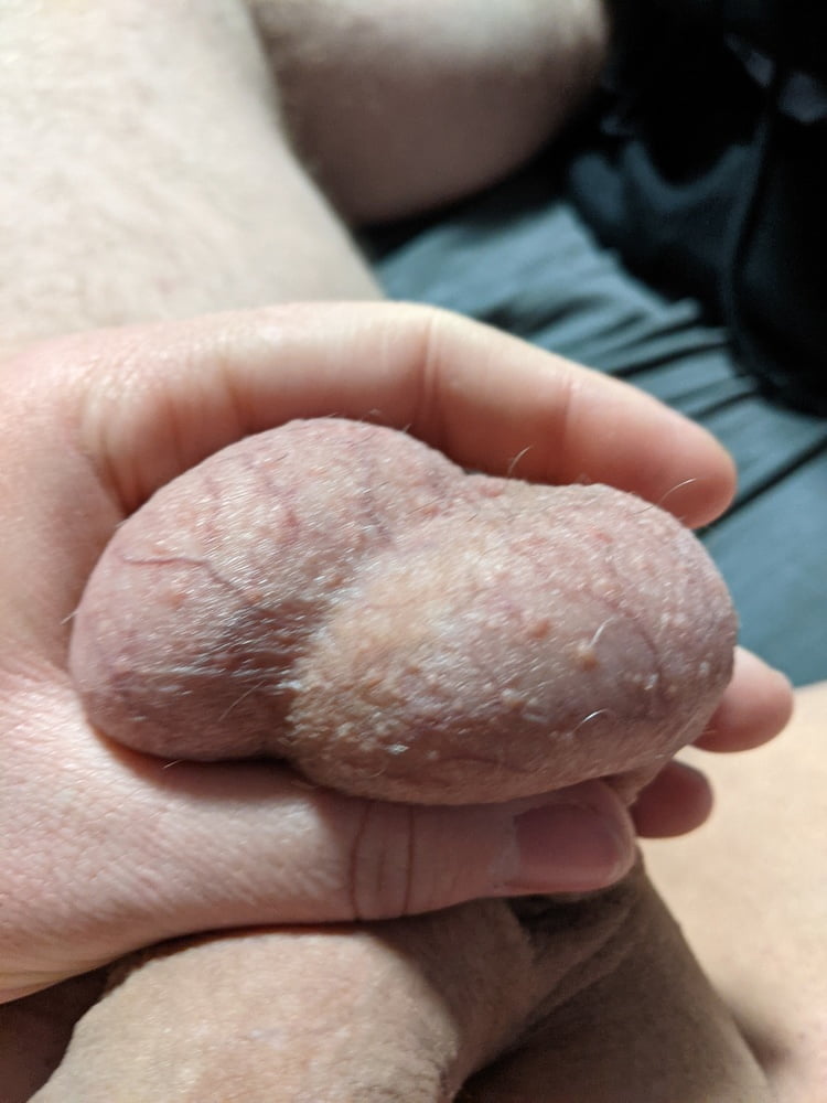 Ball Pictures #3 My balls hurting #107051382