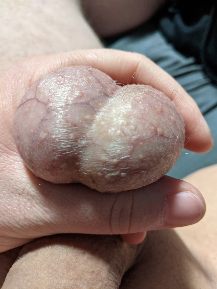 Ball Pictures #3 My balls hurting #107051385