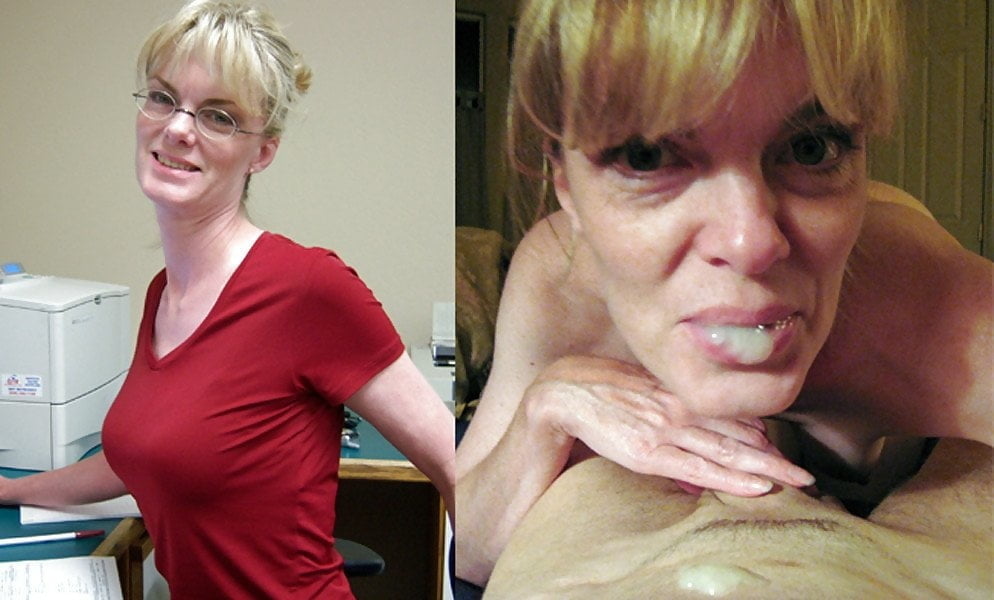 BEFORE AFTER 24 #89169142