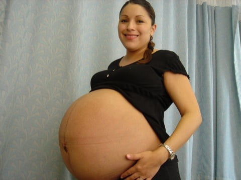 妊娠中の女性
 #104807571