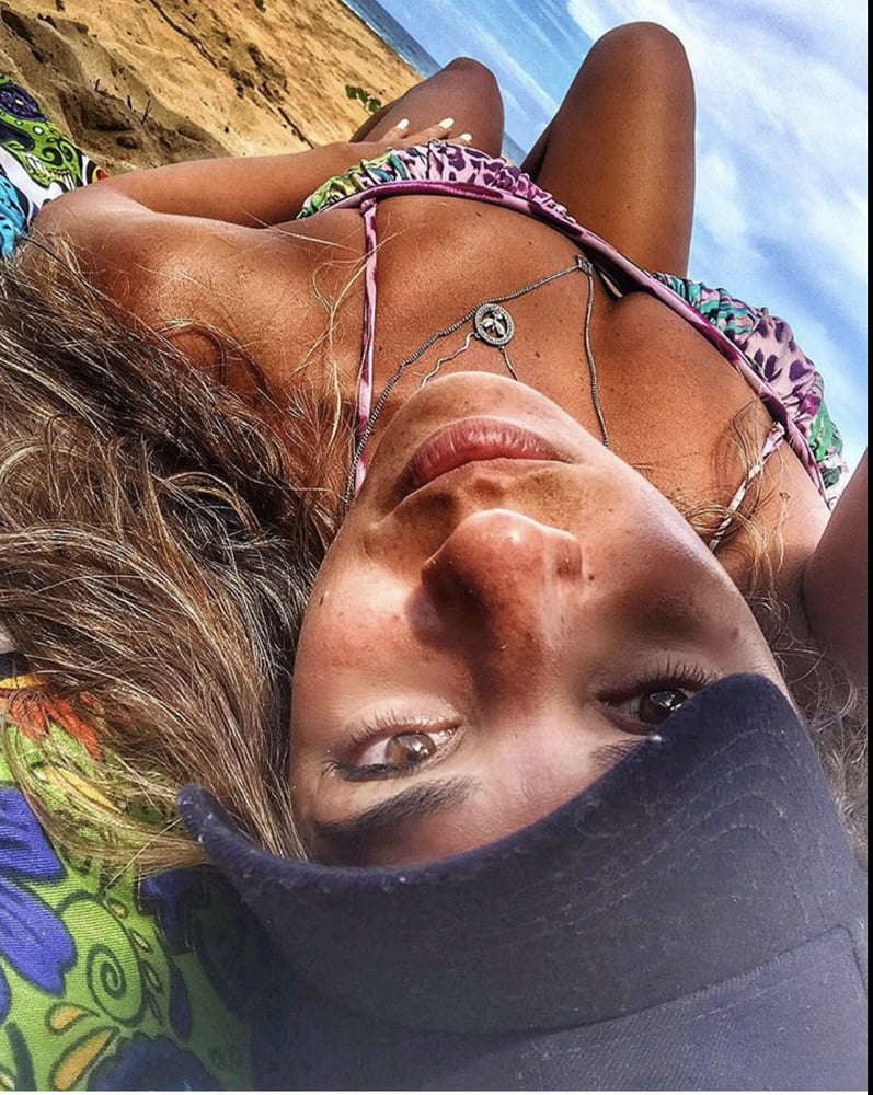 The freckles in the chest #92980901