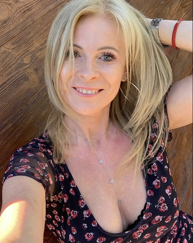 The freckles in the chest #92980936