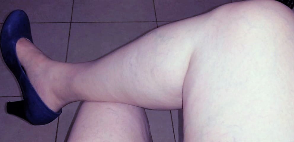 Sexy &amp; Chubby Legs 9 #106182598