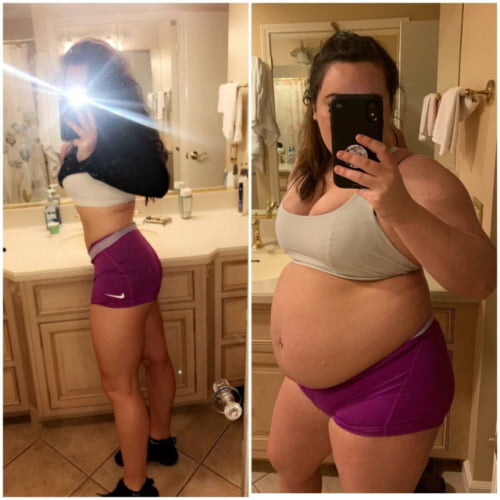 Weight Gain Before And After 3 #98435322