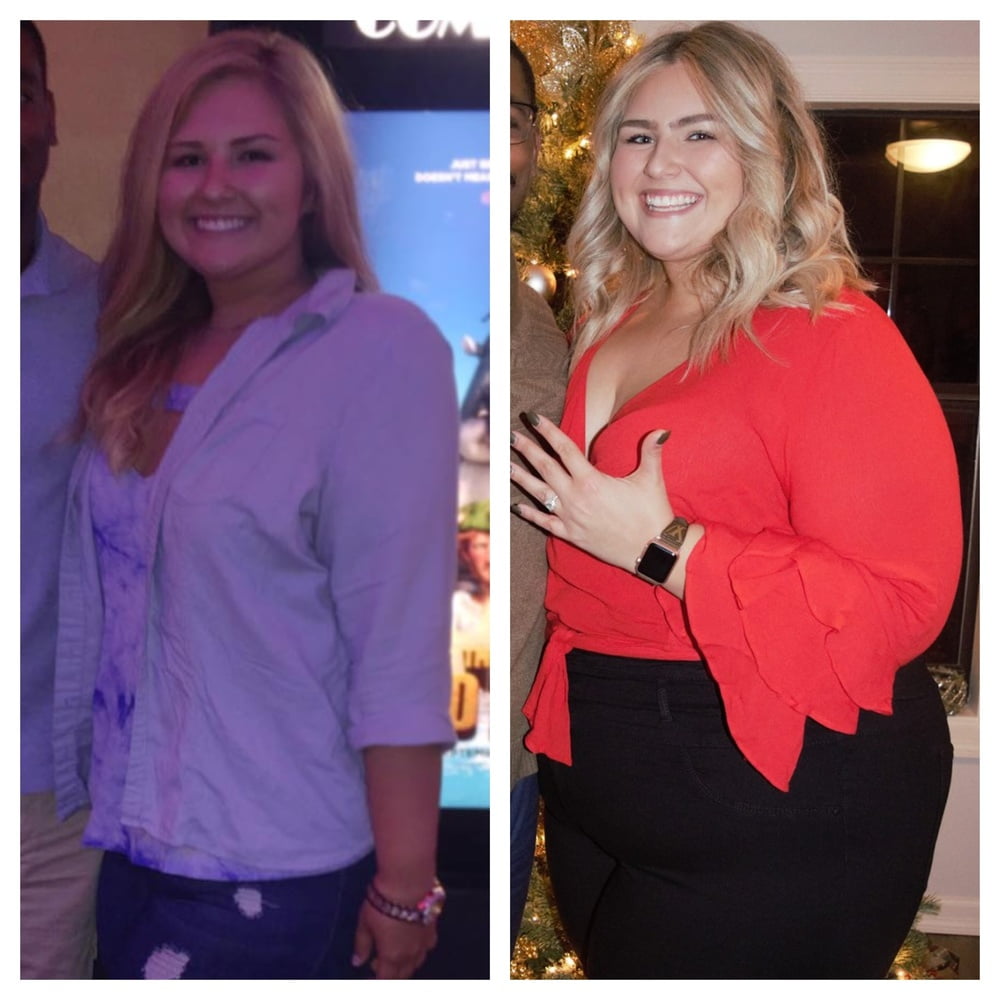 Weight Gain Before And After 3 #98435329