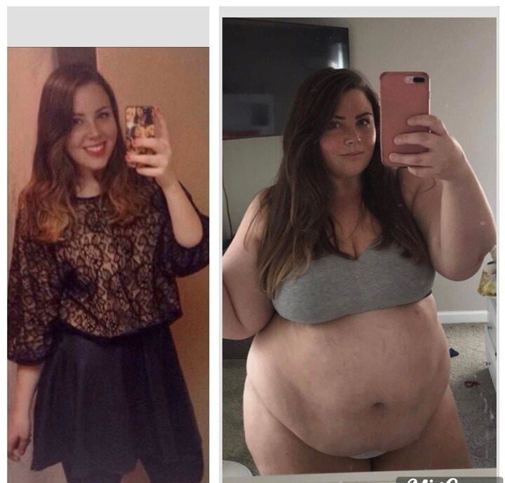 Weight Gain Before And After 3 #98435331
